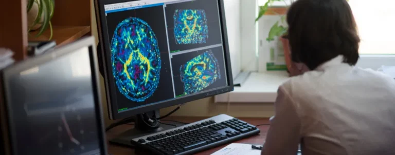 Brain Scan en monitor con un médico revisándolo