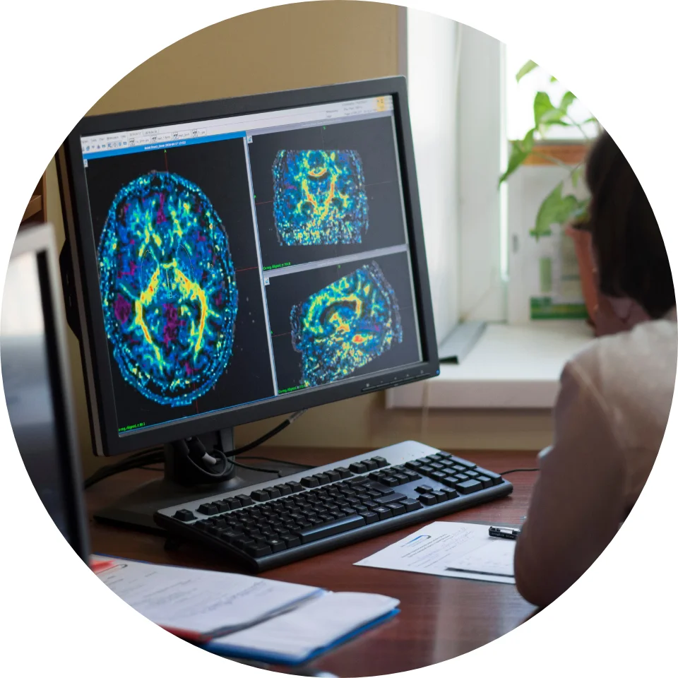 Radiólogo leyendo Brain Scan en el monitor