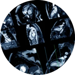 Cardiac Radiology2