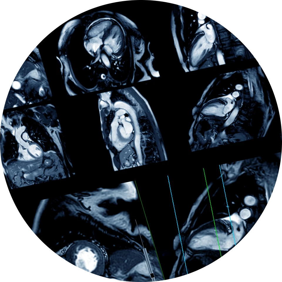 Cardiac Radiology2
