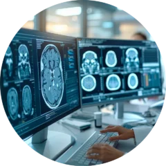 Especialidad de Neurorradiología