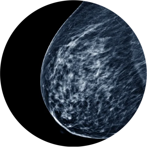 Breast Imaging