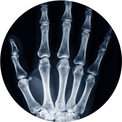 Diagnostic Imaging Hand