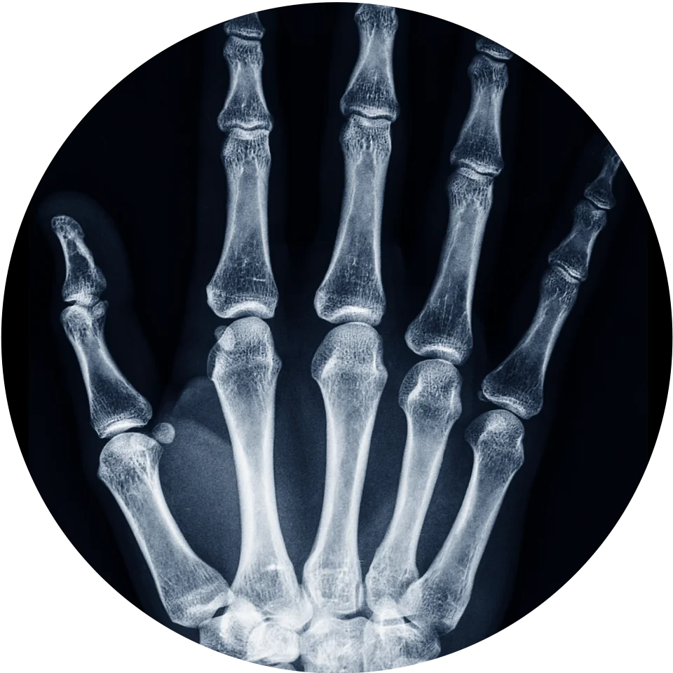 Diagnostic Imaging Hand