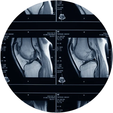 Imágenes musculoesqueléticas