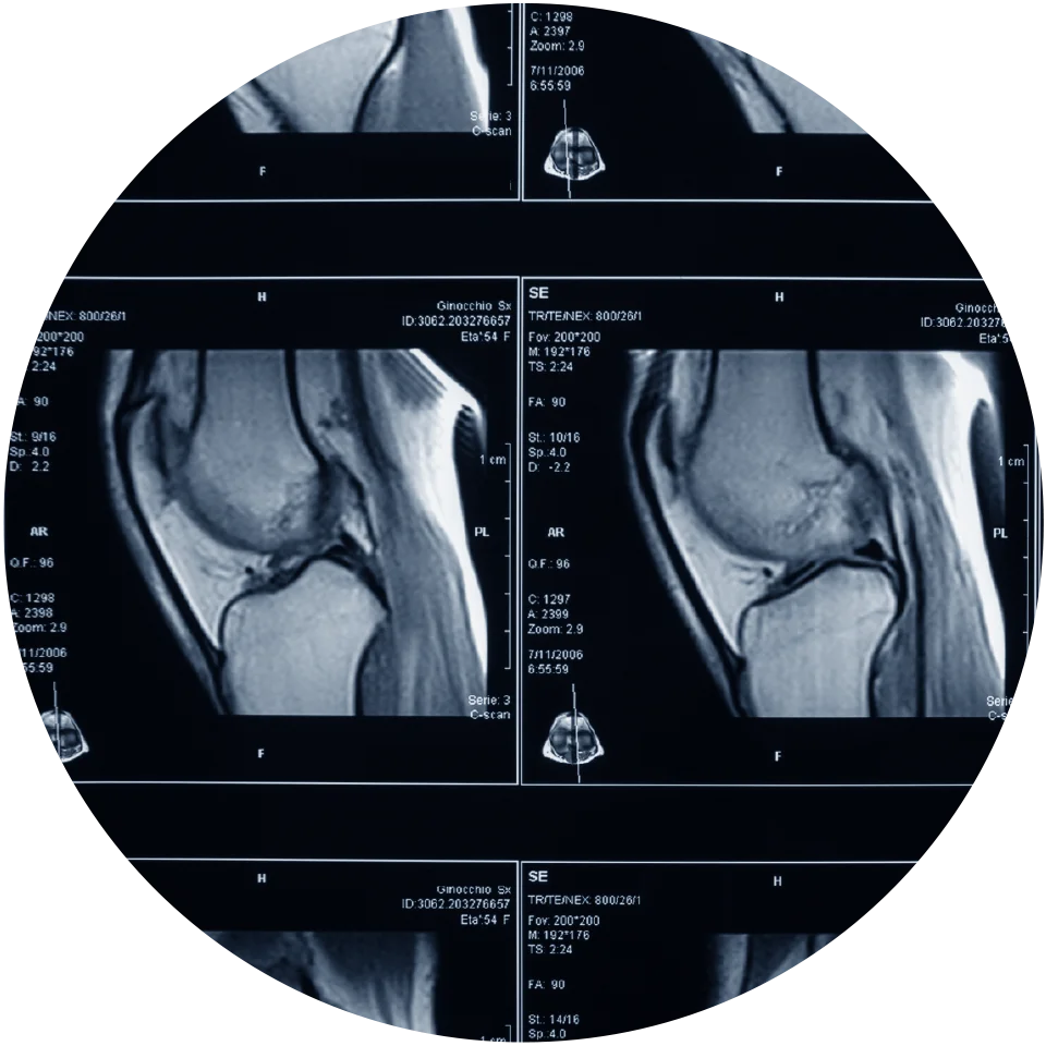 Musculoskeletal Imaging